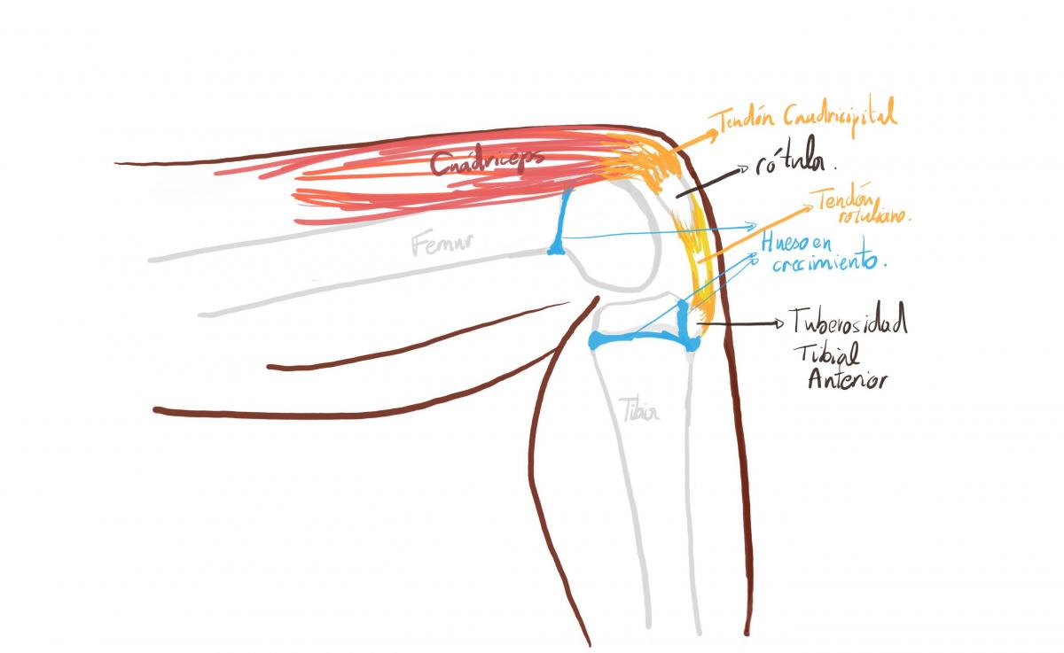 rodilla en crecimiento, tuberosidad tibial anterior