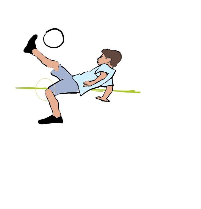 El Osgood-Schlatter es más frecuente en los niños que juegan a fútbol.