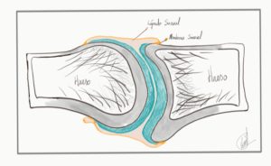 Insulina y artrosis