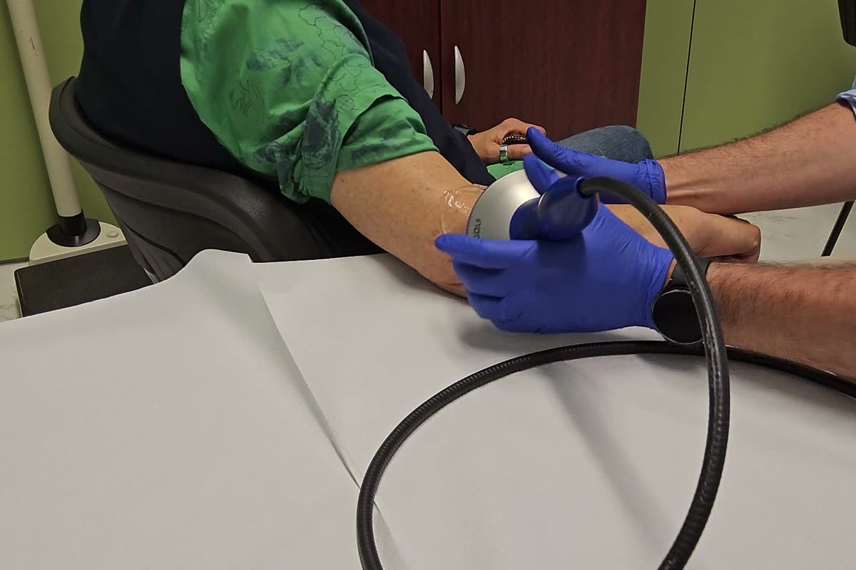 Sesión de ondas de choque focales en el codo: el fisioterapeuta localiza el punto del tendón con el aplicador